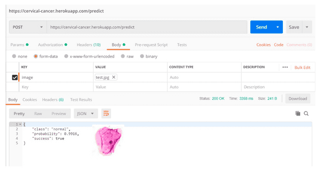 Foto de utilización de la API