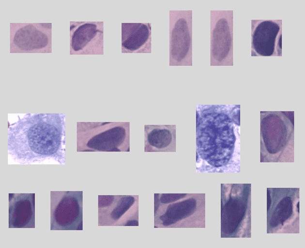 Imagen de células del dataset Smear2005
